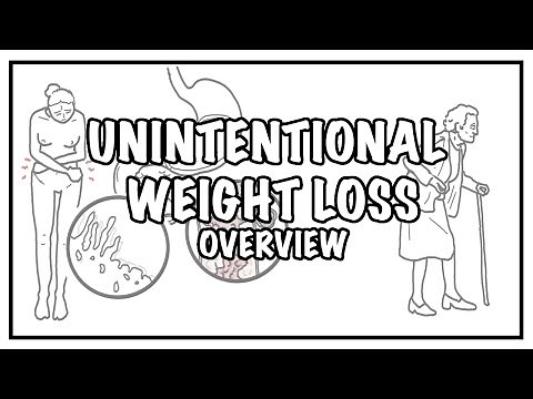 Approach to Unintentional Weight Loss - definition, differential diagnosis and treatment • Video • MEDtube.net