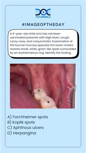👉 Identify the finding.