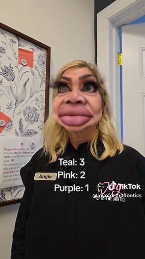 Best Colors for Braces: Pink Takes the Lead!