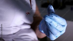 Laboratory technician dripping real human blood on a slide using a medical dispenser. Blood drips on glass and splashes in small drops. Conducting pharmacological analyses, close-up in slow motion.
