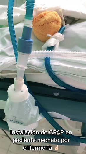 Instalacion de CPAP en neonato por ENFERMERIA❤️#enfermeria #viralvideo #signosvitales #cuidadoscriticopediatrico #ucip #estudiantedeenfermeria #estudiantedemedicina #viral #medicina #neonatologia #enfermerianeonatal #inhaloterapeutas