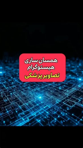 ‎آموزش متلب از صفر تا پیشرفته‎ on Instagram‎: "پروژه عملی: پیاده‌سازی تساوی‌سازی هیستوگرام روی تصاویر CT Scan! 🚀 مراحل اجرا: 1. خواندن تصویر CT اصلی 2. اعتاب تابع histeq 3. رسم هیستوگرام قبل و بعد 4. مقایسه نتایج نتیجه: بهبود قابل ملاحظه در جزئیات آناتومیکال! 🦴 کد متلب: % خواندن تصویر img = imread('ct_scan.jpg'); img_eq = histeq(img); % نمایش نتایج figure; subplot(2,2,1); imshow(img); title('تصویر اصلی'); subplot(2,2,2); imshow(img_eq); title('تصویر بهبود یافته'); subplot(2,2,3); imhist(img); 