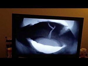 Swamp fever My Little Pony Infection au generation 5