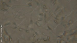 Sperm (spermatozoa) viewed under the microscope. Moving human sperm under Phase contrast Microscope. Close up showing spermatozoons. Video semen under microscope. 4K UHD