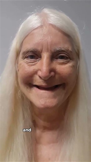 Why Missing Teeth Cause Jaw Bone Loss