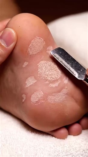 34K views · 80 reactions | Foot Cleaning Spa Exfoliation | Heel Glow NMAB #footcare #heeleexfoliation #pedicure #oddlysatisfying #dryskinremoval Enjoy clean, relaxing foot-care ASMR with gentle heel exfoliation and natural callus removal. Disclaimer: AI-generated educational & relaxation content. | Wonderful Drama | Facebook