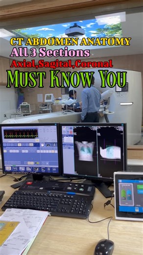 Radiology Vibes on Instagram: "Abdominal anatomy In 3 Sections, Axial, 💀Sagital,Coronal It’s basic must know you about this . Follow4More @radiology_vibe___ . #radiology #medicalimaging #doctor #ctscan #reelsviral"