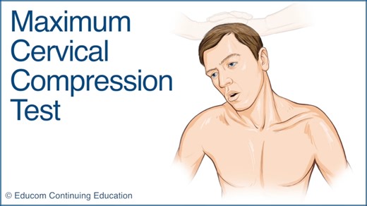 【转载】Spurling’s test