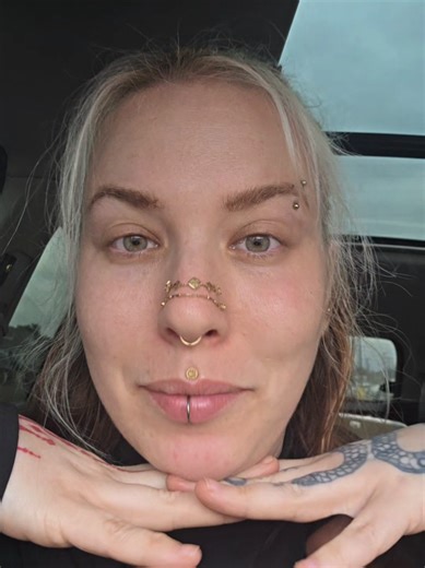 trying to be so real and get over being more open #35 #skincare #lovetheskinyourein #relatable