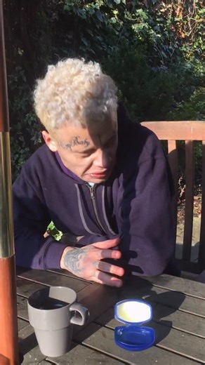 📌 Read the pinned comment before judging 💚 Severe Tourettes isn’t what most people think it is. #Tourettes #TouretteSyndrome #DisabilityAwareness #TourettesAwareness | Jack Francis