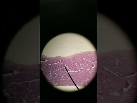 Smooth vs Skeletal vs Cardiac muscle histology