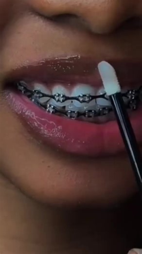 We put a smile on your smile 😊 #novagems