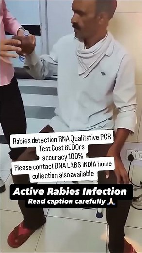 😱 Dog Bite & Rabies: What Happens If You Don't Get the Vaccine? (Symptoms & Cost)