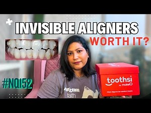 My Toothsi Aligner: Day 1| Unboxing of Toothsi Aligner + Process Explained | Kis Case Me Best Hain?