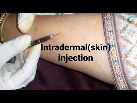 intradermal or skin injection