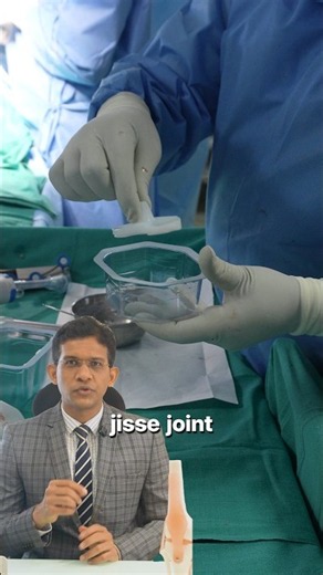 Knee Replacement surgery animation explained by an Orthopedic Surgeon