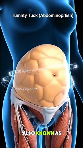 “The Truth About Tummy Tuck Surgery | Realistic Body Transformation”