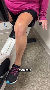 🚴‍♀️ Why Pedal Rocks & Backward Pedaling Are So Important After Knee Replacement One of the most common questions I get in the clinic is, “Why do you have me pedal backward before going forward on the bike?” It’s a great question — and there’s a reason for it. When you first start using a stationary bike after knee replacement surgery, your knee might not bend enough to make a full revolution just yet. That’s where pedal rocks come in. 👉 Pedal Rocks mean gently rocking the pedals forward and b