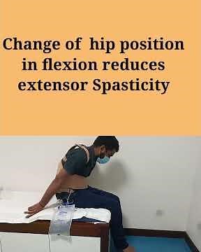 Simple techniques to reduce extensor tone/ spasticity spastic Paraplegic: Change in hip position