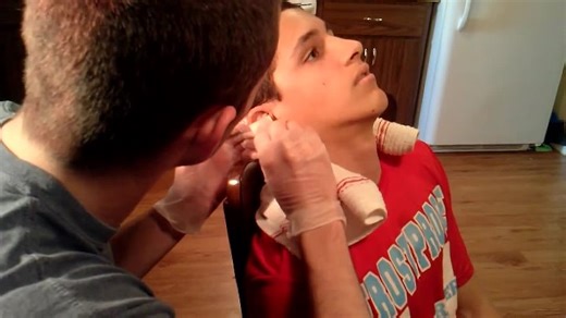 Cauliflower ear draining