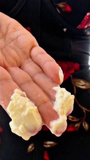 Yeast infection: How to get rid of itching, odor, and discharge in 24 hours.