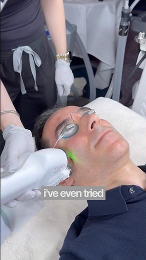 One of The Most Effective Skin Rejuvenation Methods