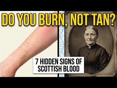 7 Hidden Signs Your Family Has Scottish Blood