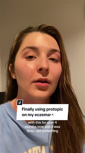 Managing Eczema with Protopic: My 4-Night Journey