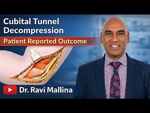Cubital Tunnel Syndrome Surgery (Patient Outcomes)