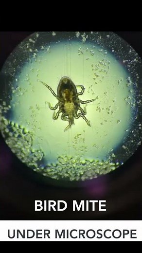 Bird Mite Up Close and Personal Under A Microscope