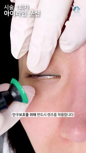 아이라인 문신 제거 서비스 소개
