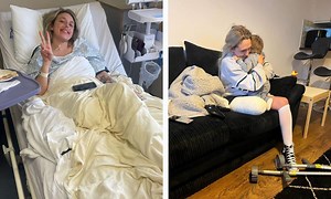 Dundee mum, 25, has leg amputated after cancer diagnosis