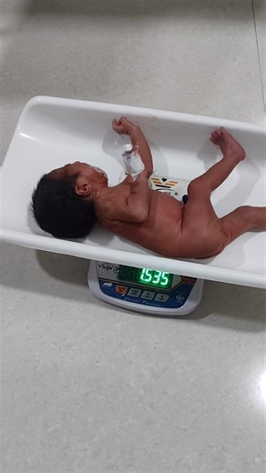 A new life begins with promise as a baby is born, weighing 1.540kg and thriving in stable condition#Life #cutebaby #newbornbaby #PeacefulSleep #hospitalbaby #nicubaby #10daysold #newborn #SleepingBaby #babycare #sweetdreams | Little Angel Care