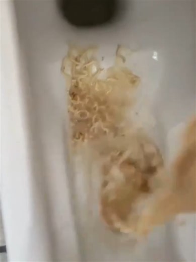 公園での嘔吐実録