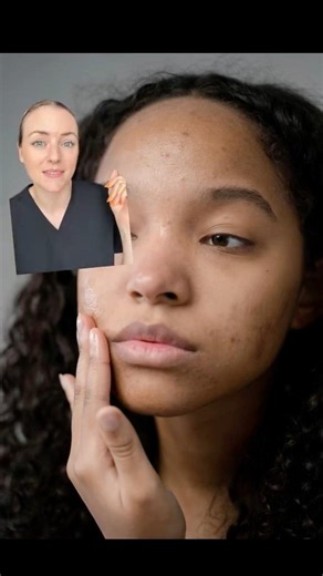 How to know if you've damaged your skin barrier
