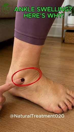 Ankle Swelling? What causes it? #anklehealth #movement #health