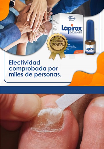 Confía en la laca #1 en ventas de Costa Rica por su efectividad, estudios clínicos lo comprueban #hongosenlasuñas #saludybienestar #piessanos #tipsdesalud #onicomicosis #hongos #dermatology #dermatips #uñassanas #lapirox