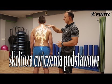 Skolioza (skrzywienie kręgosłupa) ćwiczenia korekcja wad postawy 1/3
