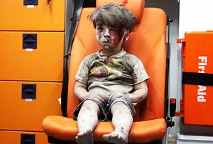 Syrian boy who shocked the world looks very different now he's happy and healthy - Extra.ie