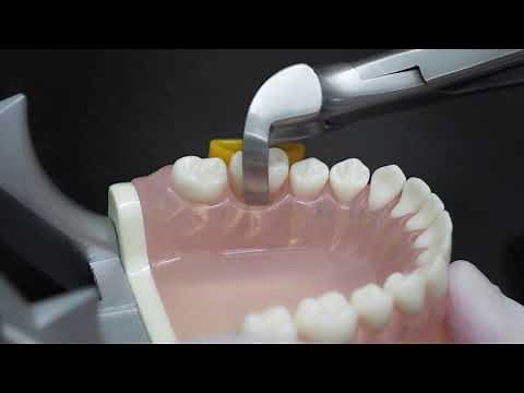 Physics Forceps Atraumatic Extraction System, Tooth Extraction - Dentist Review & Testimonial