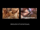 Surgical Videos for Anatomy • Video • MEDtube.net