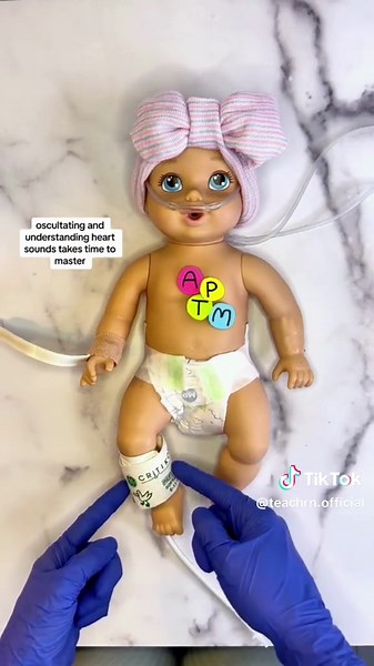 Tiny hearts, big skills! 🩺👶 Master the art of pediatric auscultation—know where to place your stethoscope and recognize crucial heart sounds. 💙🎧 Thank you for sharing @nurse.tori_ 🙌 #nurseanesthesia #nursingstudent #ICUnurse #CRNAschool #Auscultation #NICU