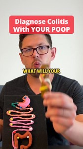 48K views · 255 reactions | How To Diagnose Colitis With Your Poop! | Heal Your Gut Guy | Facebook