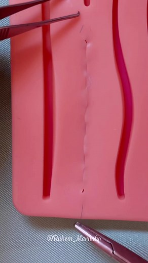 Cómo retirar sutura intradérmica correctamente