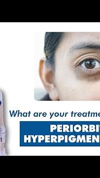 Periorbital Hyperpigmentation how to treat and how to cure | Dr. Rohit Batra explains