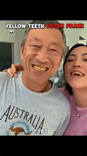Yellow teeth 🥶 #phonk #music #trollface