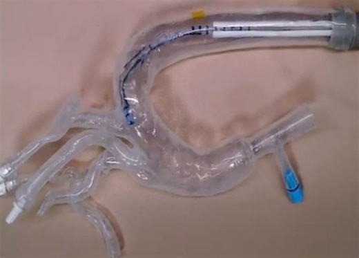 Soft robotic ‘vine’ navigates arteries and jet engines with life-like motion