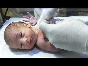 Newborn Baby Suction Procedure in NICU | How to Safely Remove Mucus#newbornbaby#cutebaby