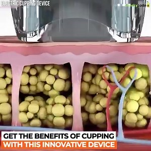 6.3M views · 191 reactions | 449 Kč  푽풚́풑풓풐풅풆풋 trvá do konce neděle Klikněte pro více informací https://top.frilla.cz/cuppy/t1/v1/lp1?sp=77449i007&sd=4430x | Frilla | Facebook