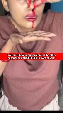 S.291||Nose Bleeding First Aid||#shorts,#shortvideo,#healthtips,#drmohofilmondal..